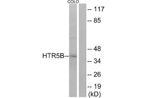 Western blot analysis of extracts from COLO cells, using HTR5B antibody.