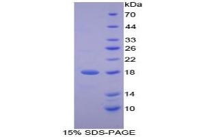 SDS-PAGE analysis of Human LTbR Protein. (LTBR 蛋白)
