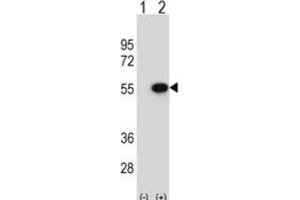 Western Blotting (WB) image for anti-Reptin,TIP49B,RUVB2 antibody (ABIN2995224) (Reptin,TIP49B,RUVB2 抗体)