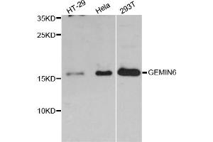 Western blot analysis of extracts of various cell lines, using GEMIN6 antibody (ABIN5997788) at 1:3000 dilution. (GEMIN6 抗体)