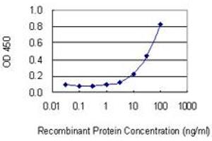 Detection limit for recombinant GST tagged SP140 is 0. (SP140 抗体  (AA 504-612))