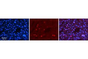 Rabbit Anti-ZNF3 Antibody      Formalin Fixed Paraffin Embedded Tissue: Human Adult Liver   Observed Staining: Nuclear in hepatocytes, moderate signal, low tissue distribution  Primary Antibody Concentration: 1:100  Secondary Antibody: Donkey anti-Rabbit-Cy3  Secondary Antibody Concentration: 1:200  Magnification: 20X  Exposure Time: 0. (ZNF3 抗体  (N-Term))