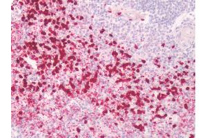 Human Spleen: Formalin-Fixed, Paraffin-Embedded (FFPE)