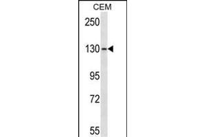 GRM1 Antibody (C-term) (ABIN657624 and ABIN2846620) western blot analysis in CEM cell line lysates (35 μg/lane). (Metabotropic Glutamate Receptor 1 抗体  (C-Term))