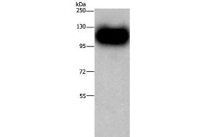 Western Blot analysis of Mouse brain tissue using MAG Polyclonal Antibody at dilution of 1:450 (MAG 抗体)
