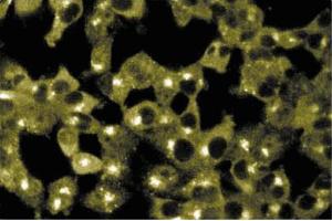 Immunofluorescence staining of ES-2 cells (Human ovary clear cell carcinoma, ATCC CRL-1978). (Sorting Nexin 2 抗体  (AA 15-137))
