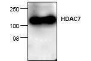 Image no. 1 for anti-Histone Deacetylase 7 (HDAC7) antibody (ABIN127244) (HDAC7 抗体)