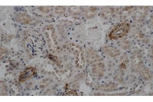 Immunohistochemistry of paraffin-embedded Mouse kidney using ACTA2 Polyclonal Antibody at dilution of 1:50 (Smooth Muscle Actin 抗体)
