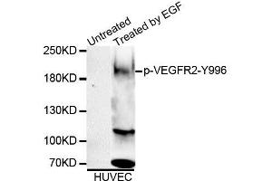 Western blot analysis of extracts of HUVEC cell line, using Phospho-VEGFR2-Y996 antibody (ABIN5995624). (VEGFR2/CD309 抗体  (pTyr996))