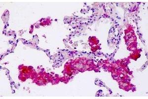 Human Lung, Macrophages: Formalin-Fixed, Paraffin-Embedded (FFPE) (Coronin 6 抗体  (AA 337-365))