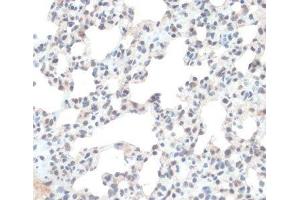 Immunohistochemistry of paraffin-embedded Rat lung using TXN Polyclonal Antibody at dilution of 1:100 (40x lens). (TXN 抗体)