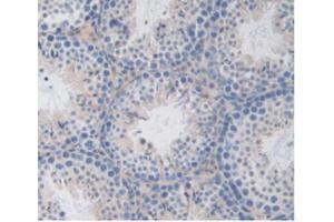 IHC-P analysis of Mouse Testis Tissue, with DAB staining. (LSR 抗体  (AA 35-205))