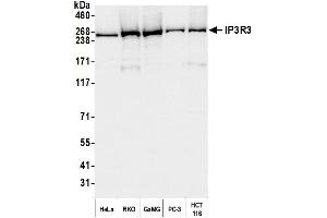 Western Blotting (WB) image for anti-Inositol 1,4,5-Trisphosphate Receptor, Type 3 (ITPR3) (AA 625-675) antibody (ABIN7454435)