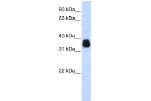 WB Suggested Anti-SCYE1 Antibody Titration:  0. (AIMP1 抗体  (Middle Region))