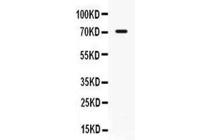 Western blot analysis of IL7R alpha expression in 22RV1 whole cell lysates ( Lane 1). (IL7R 抗体  (C-Term))