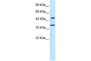 Human Jurkat; WB Suggested Anti-PNMA1 Antibody Titration: 0. (PNMA1 抗体  (Middle Region))
