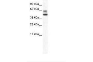 Image no. 1 for anti-Zinc Finger and BTB Domain Containing 7A (ZBTB7A) (AA 114-163) antibody (ABIN202736) (ZBTB7A 抗体  (AA 114-163))