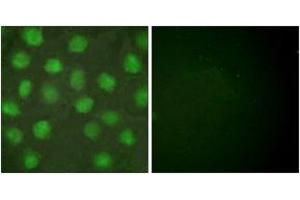 Immunofluorescence analysis of HuvEc cells, using Retinoid X Receptor gamma Antibody. (Retinoid X Receptor gamma 抗体  (AA 171-220))