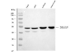 Western blot analysis of TRIP/TRAIP using anti-TRIP/TRAIP antibody (ABIN7599419). (TRAIP 抗体  (AA 1-469))