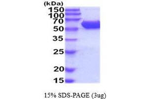 SDS-PAGE (SDS) image for Carboxylesterase 2E (CES2E) (AA 27-559) (Active) protein (His tag) (ABIN5854477) (Carboxylesterase 2E (CES2E) (AA 27-559) (Active) protein (His tag))