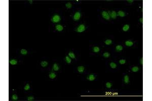 Immunofluorescence (IF) image for anti-Topoisomerase I Binding, arginine/serine-Rich, E3 Ubiquitin Protein Ligase (TOPORS) (AA 98-205) antibody (ABIN564418)