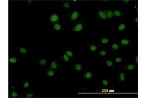 Immunofluorescence of monoclonal antibody to TOPORS on HeLa cell. (TOPORS 抗体  (AA 98-205))