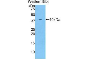 Western Blotting (WB) image for anti-Complement Component C7 (C7) (AA 725-838) antibody (ABIN1858199) (C7 抗体  (AA 725-838))