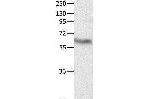 Western Blot analysis of Huamn fetal brain tissue using CRMP3 Polyclonal Antibody at dilution of 1:500 (DPYSL4 抗体)