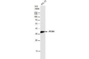 WB Image PCNA antibody detects PCNA protein by western blot analysis. (PCNA 抗体)
