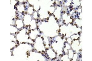 Immunohistochemistry of paraffin-embedded Mouse lung using CBX5 Polyclonal Antibody at dilution of 1:100 (40x lens). (CBX5 抗体)