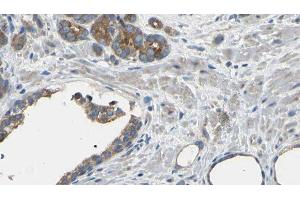ABIN6275122 at 1/100 staining Human prostate tissue by IHC-P. (EIF3D 抗体  (Internal Region))