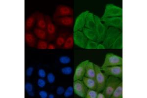 ABIN6261305 and ABIN6276929 staining Hela cells by IF/ICC. (DKC1 抗体  (Internal Region))
