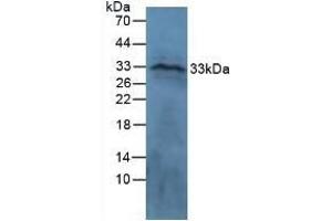 Detection of CTGF in Ovine Brain Tissue using Polyclonal Antibody to Connective Tissue Growth Factor (CTGF) (CTGF 抗体  (AA 101-330))