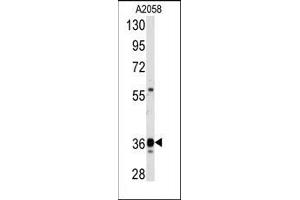 Image no. 1 for anti-Glyceraldehyde-3-Phosphate Dehydrogenase (GAPDH) (C-Term) antibody (ABIN360237) (GAPDH 抗体  (C-Term))