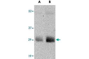Western blot analysis of GBAS in human skeletal muscle tissue lysate with GBAS polyclonal antibody  at (A) 0. (GBAS 抗体  (N-Term))