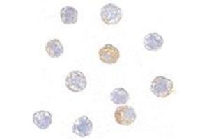 Immunocytochemistry of TDP43 in HeLa cells with this product at 5 μg/ml. (TARDBP 抗体  (Center))