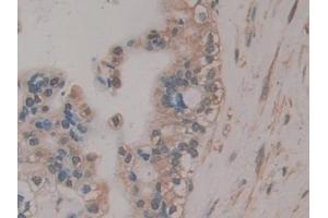 Immunohistochemistry (IHC) image for anti-R-Spondin 3 (RSPO3) (AA 22-272) antibody (ABIN7430150)