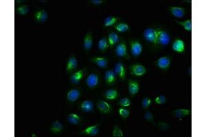 Immunofluorescence staining of Hela cells with ABIN7127692 at 1:100, counter-stained with DAPI. (Recombinant ERN1 抗体  (pSer724))