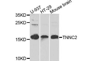 Western blot analysis of extracts of various cells, using TNNC2 antibody. (TNNC2 抗体)