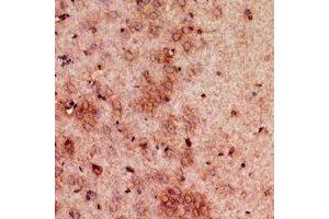 Immunohistochemical analysis of GDI2 staining in mouse brain formalin fixed paraffin embedded tissue section. (GDI2 抗体  (C-Term))