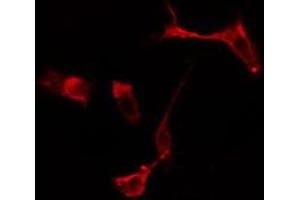 ABIN6275092 staining  Hela cells by IF/ICC. (RFWD2 抗体  (Internal Region))