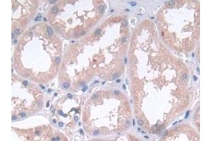 Detection of LIF in Human Kidney Tissue using Polyclonal Antibody to Leukemia Inhibitory Factor (LIF) (LIF 抗体  (AA 2-201))