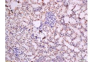 Formalin-fixed and paraffin embedded rat kidney tissue labeled with Rabbit Anti-Urocortin 3 Polyclonal Antibody, Unconjugated at 1:200 followed by conjugation to the secondary antibody and DAB staining (UCN3 抗体  (AA 120-157))