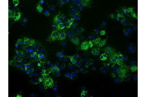 Anti-FAHD2A mouse monoclonal antibody (ABIN2453018) immunofluorescent staining of COS7 cells transiently transfected by pCMV6-ENTRY FAHD2A (RC211128). (FAHD2A 抗体)