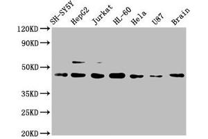 Western Blot Positive WB detected in: SH-SY5Y whole cell lysate, HepG2 whole cell lysate, Jurkat whole cell lysate, HL-60 whole cell lysate, Hela whole cell lysate, U87 whole cell lysate, Mouse brain tissue All lanes: CCR9 antibody at 1 μg/mL Secondary Goat polyclonal to rabbit IgG at 1/50000 dilution Predicted band size: 43, 41 KDa Observed band size: 43 KDa (Recombinant CCR9 抗体)