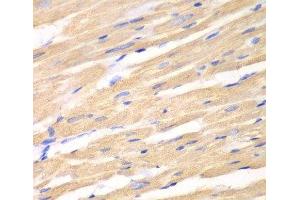 Immunohistochemistry of paraffin-embedded Rat heart using DKK3 Polyclonal Antibody at dilution of 1:100 (40x lens). (DKK3 抗体)