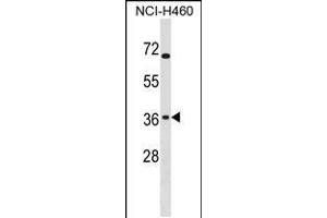 Western blot analysis in NCI-H460 cell line lysates (35ug/lane). (ST6GALNAC4 抗体  (C-Term))