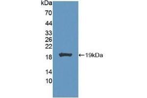 Detection of Recombinant CA7, Mouse using Polyclonal Antibody to Carbonic Anhydrase VII (CA7) (CA7 抗体  (AA 58-217))