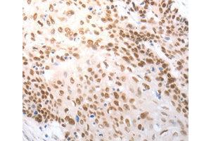 Immunohistochemistry (IHC) image for anti-Solute Carrier Family 22 (Organic Anion Transporter), Member 8 (SLC22A8) antibody (ABIN1874817) (SLC22A8 抗体)