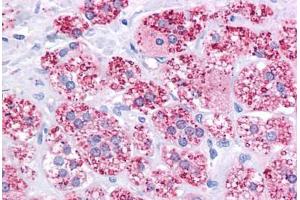 Human Adrenal: Formalin-Fixed, Paraffin-Embedded (FFPE)